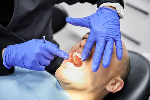 Best Emergency Tooth Extraction in Towson, MD