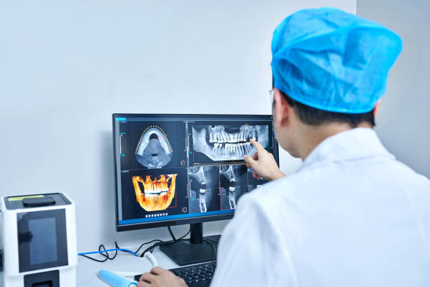 Best Emergency Root Canal Treatment in Towson, MD