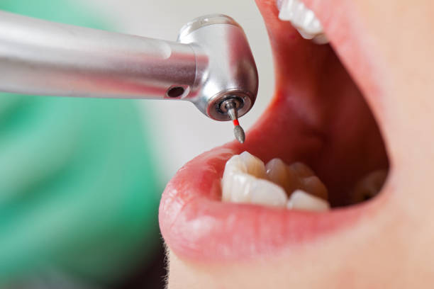 Best Emergency Dental Surgery in Towson, MD